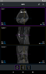 IDV - IMAIOS DICOM Viewer 2.5.0
