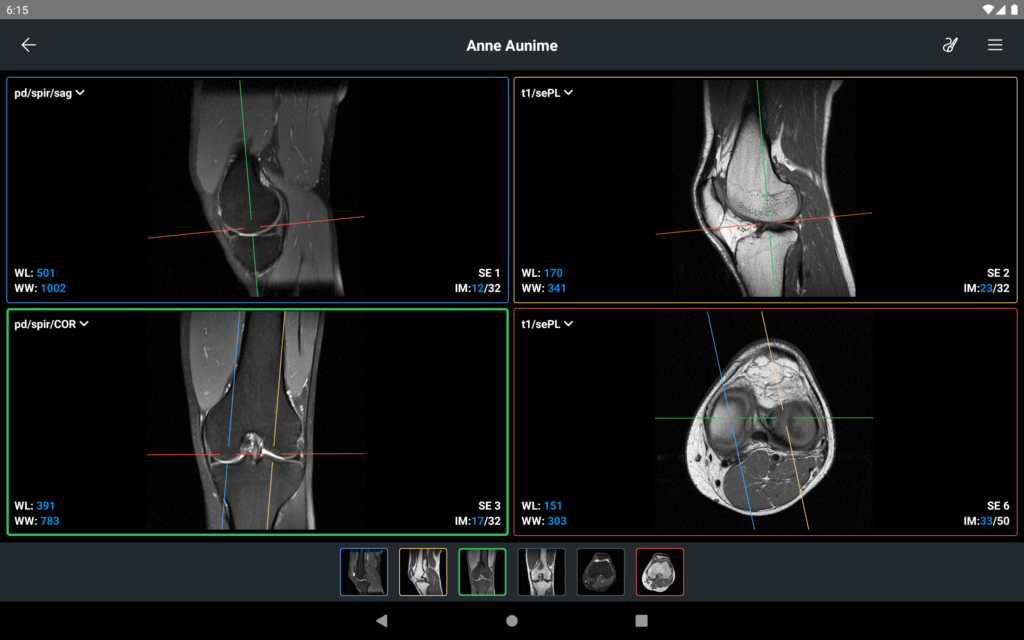 IDV - IMAIOS DICOM Viewer 2.5.0 APK Download by IMAIOS SAS - APKMirror