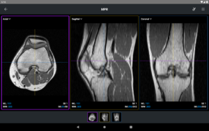 IDV - IMAIOS DICOM Viewer 2.5.0