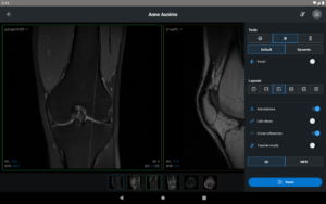 IDV - IMAIOS DICOM Viewer 2.5.0