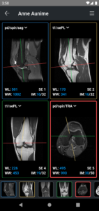 IDV - IMAIOS DICOM Viewer 2.5.0