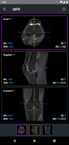 IDV - IMAIOS DICOM Viewer 2.5.0