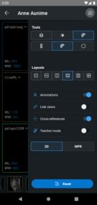 IDV - IMAIOS DICOM Viewer 2.5.0
