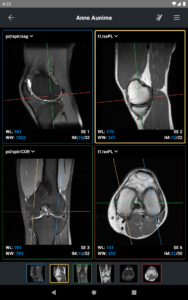 IDV - IMAIOS DICOM Viewer 2.5.0