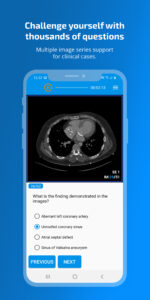 Qevlar Radiology 3.0.4