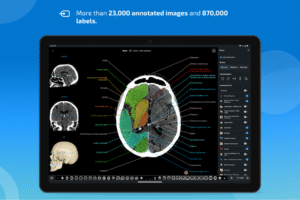 IMAIOS e-Anatomy 7.10.0