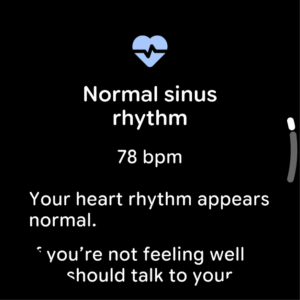 Google ECG App (Wear OS) 1.0.15141.8-release